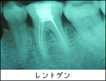 治療の基本