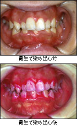 治療の基本