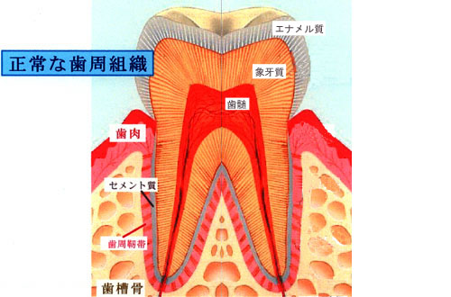 歯周治療