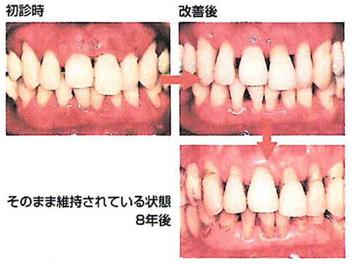 ●定期健診を受けている人の状態